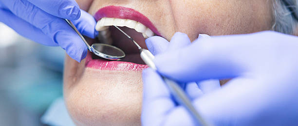 Best Emergency Treatment for Toothache in Lifornia Polytechnic State University, CA